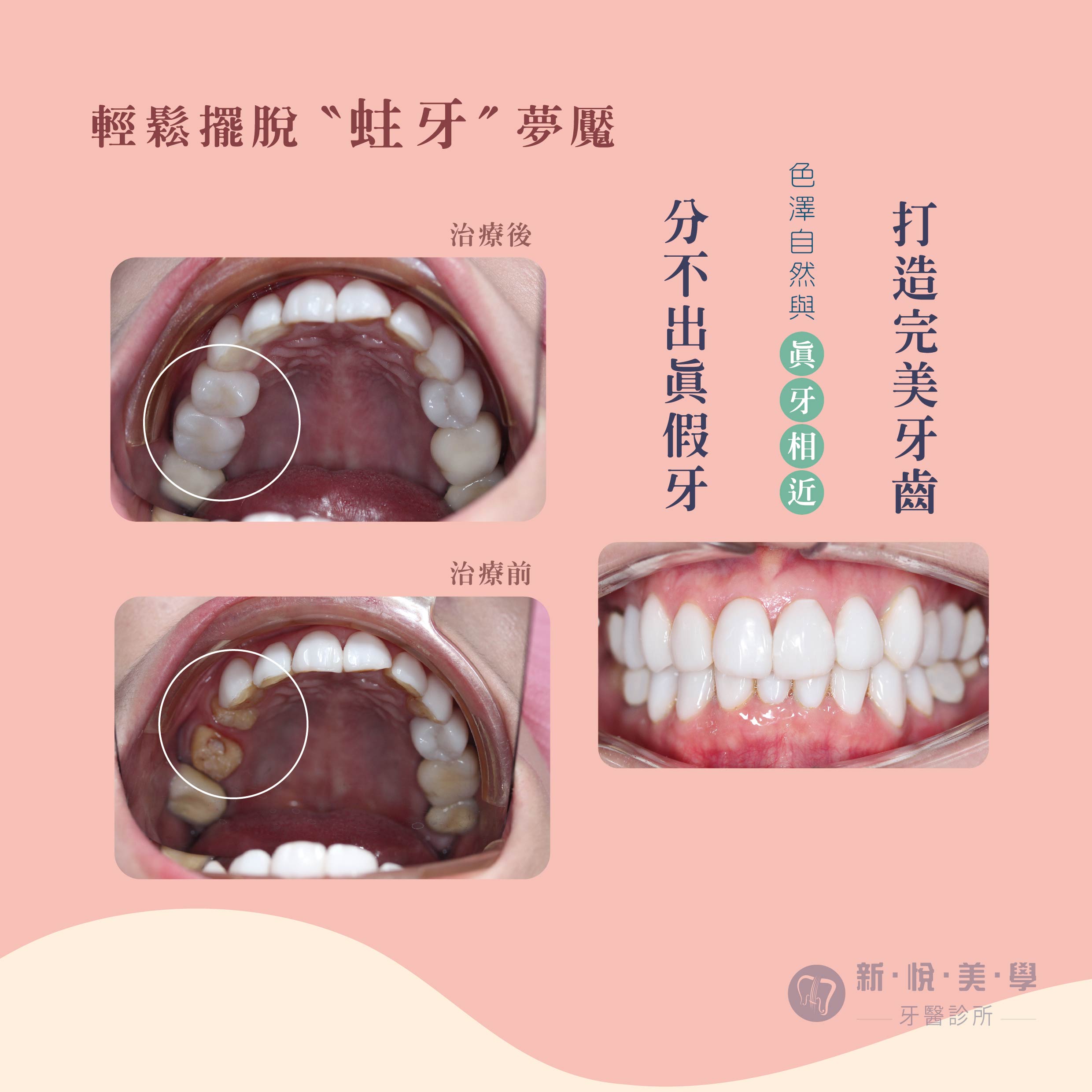 鋼琴白老師 笑容閃耀回歸的第2張圖片